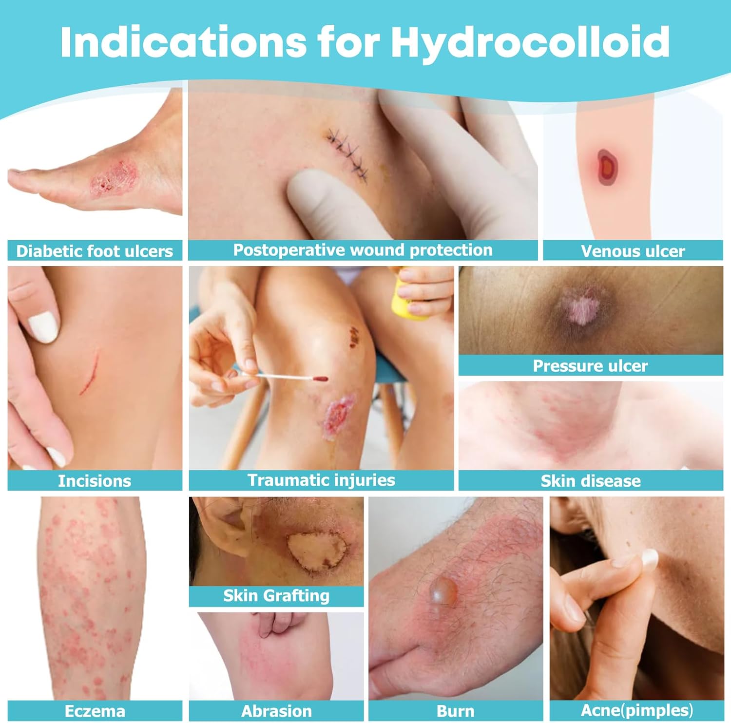 LIFARA Custom Hydrocolloid Bandage Roll™