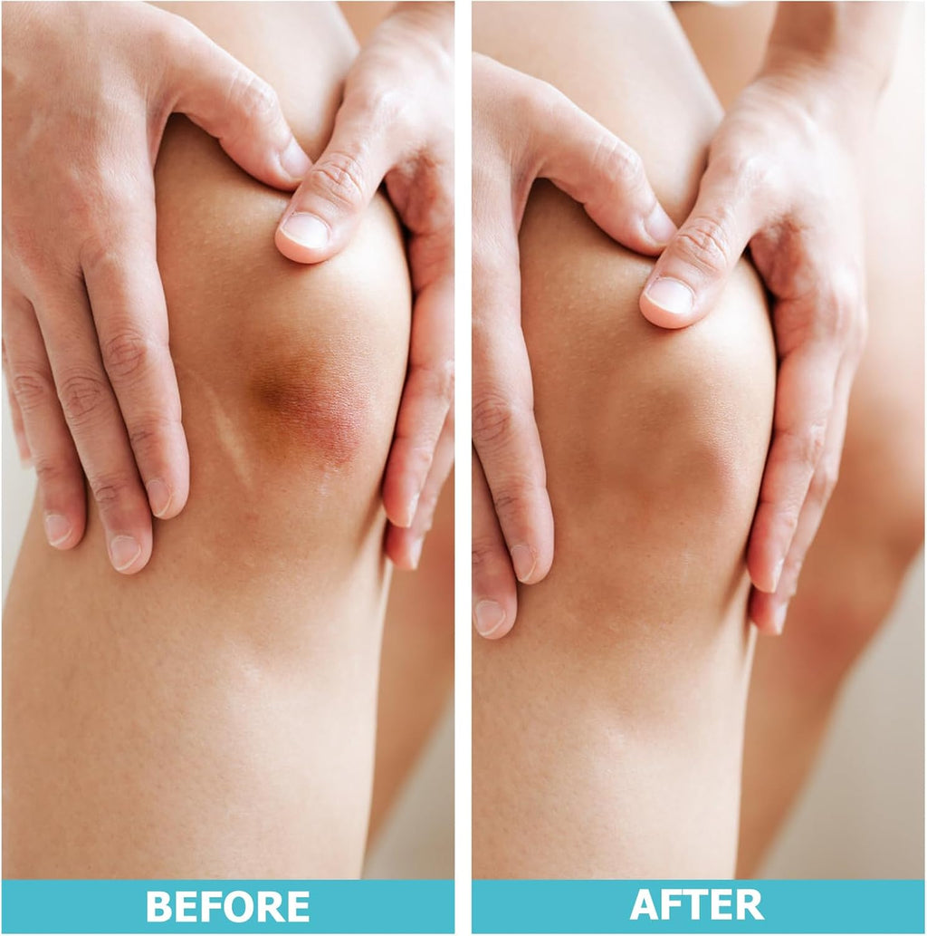 LIFARA Custom Hydrocolloid Bandage Roll™