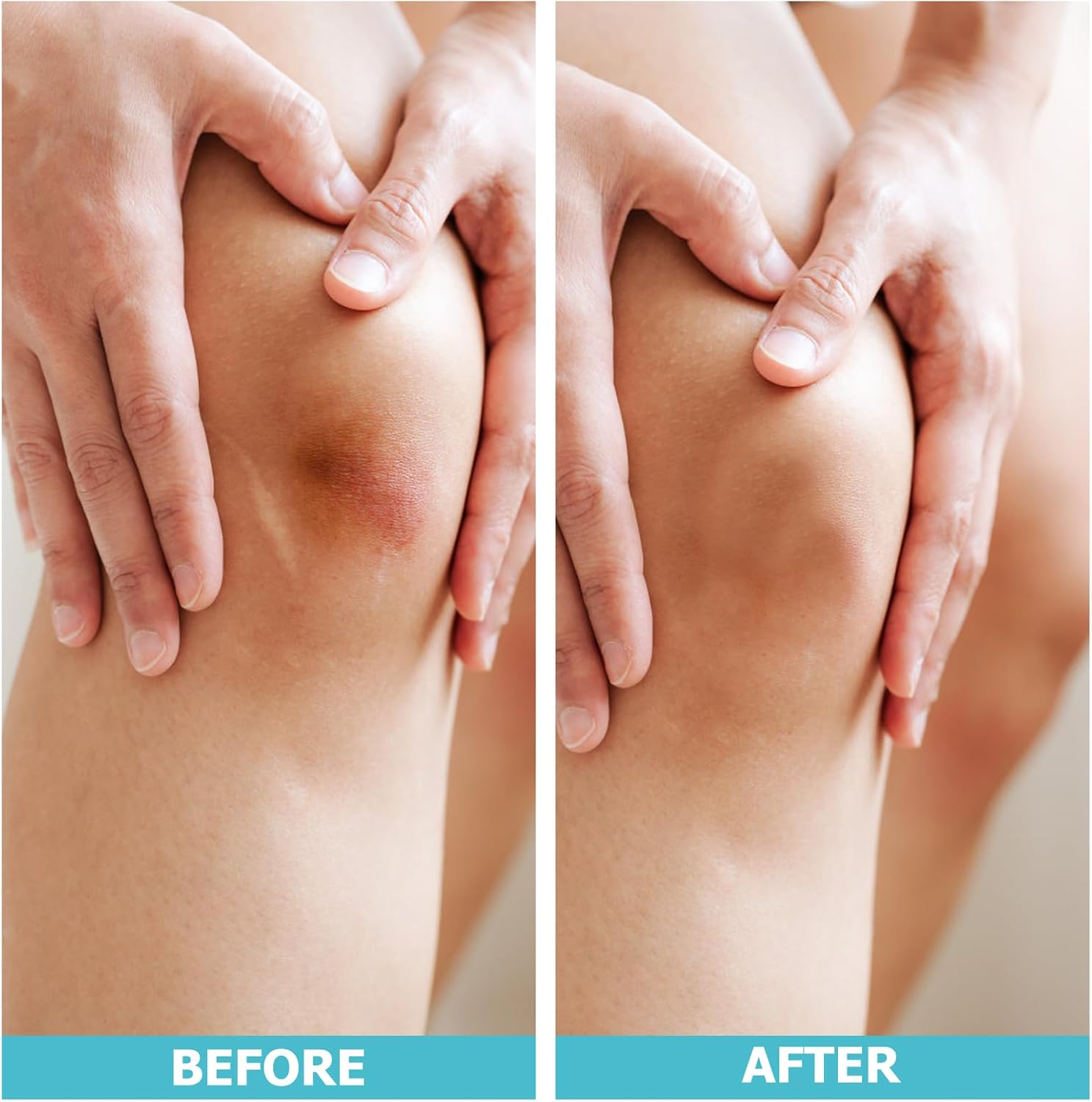 LIFARA Custom Hydrocolloid Bandage Roll™